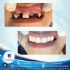 کلینیک دندانپزشکی لبخند،جراحی ایمپلنت پیشرفته ,...