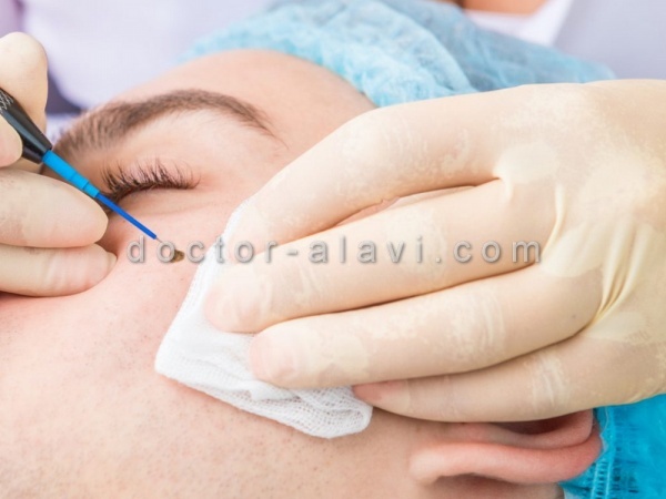 لیزر ضایعات پوستی