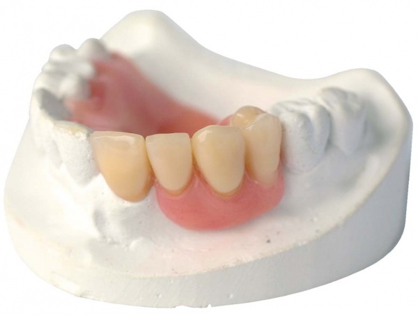 گچ دندان پزشکی